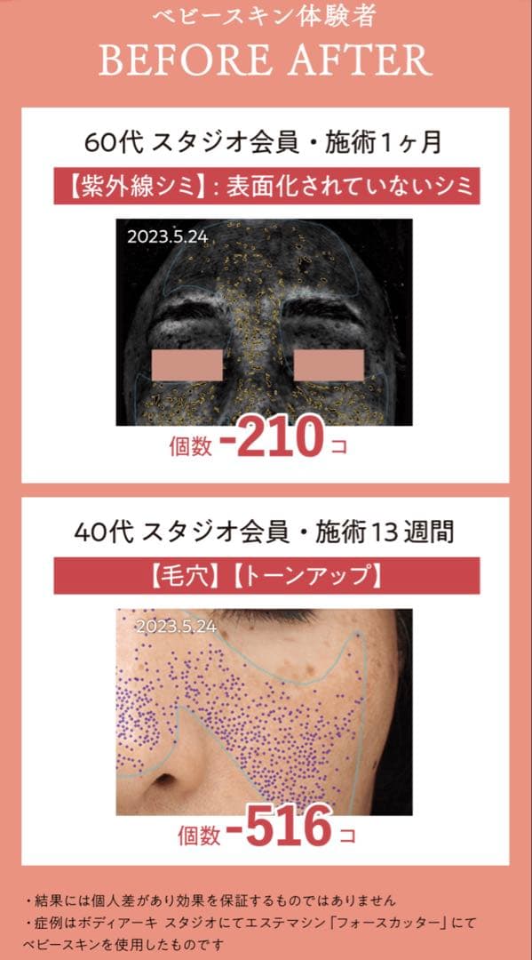 BODY ARCHI ドクターズ セルフエステセット 話題の幹細胞 ベビースキン